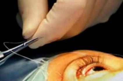 Six lose eyesight after cataract surgery in Varanasi. | India News