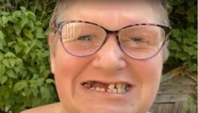 Woman Could not Find A Dentist She Pulled Out 13 Of Her Own Teeth